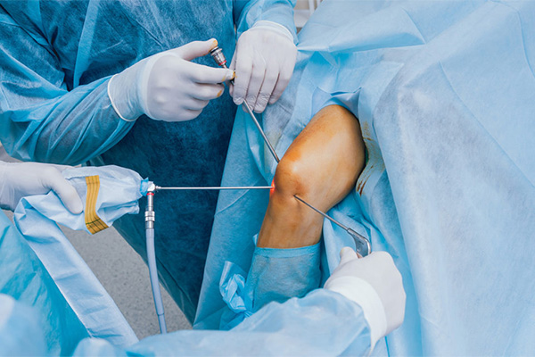 knee replacement and arthroscopy