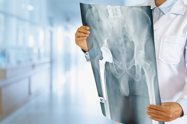 Coastal Ortho hip replacement surgery how to care for your h