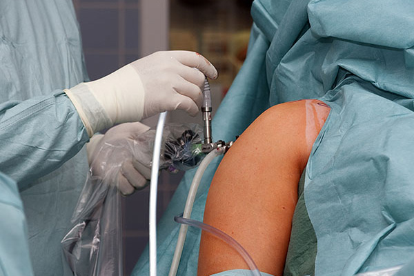 Schulter Operation