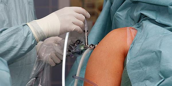 Schulter Operation