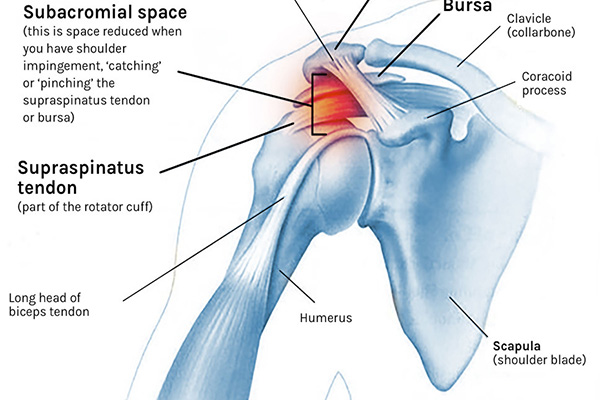 what is shoulder