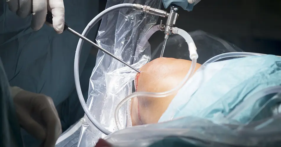 Advanced Options for Knee Surgery and Arthroscopy