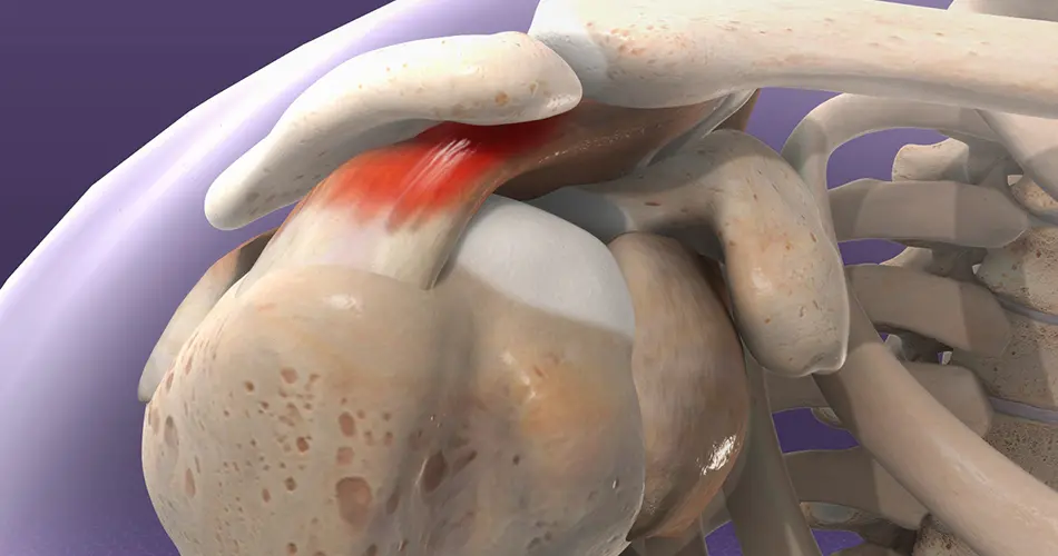 Advanced Options for Shoulder Surgery