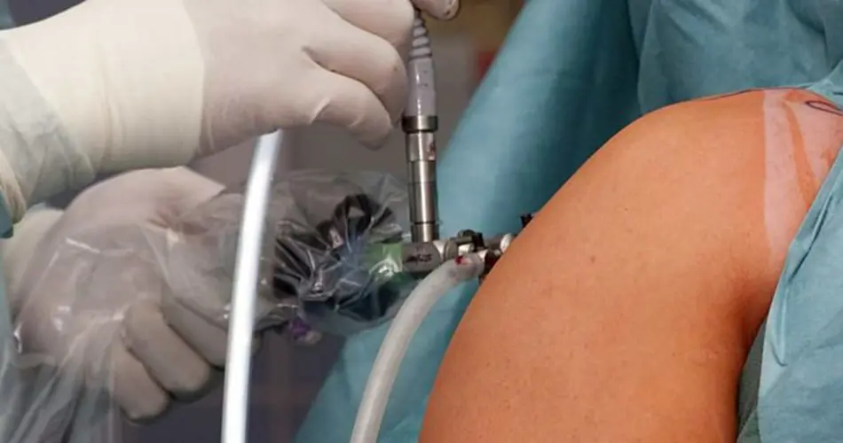 Advanced Options for Shoulder Surgery