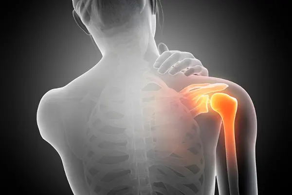 Key Highlights of Frozen Shoulder Arthroscopy