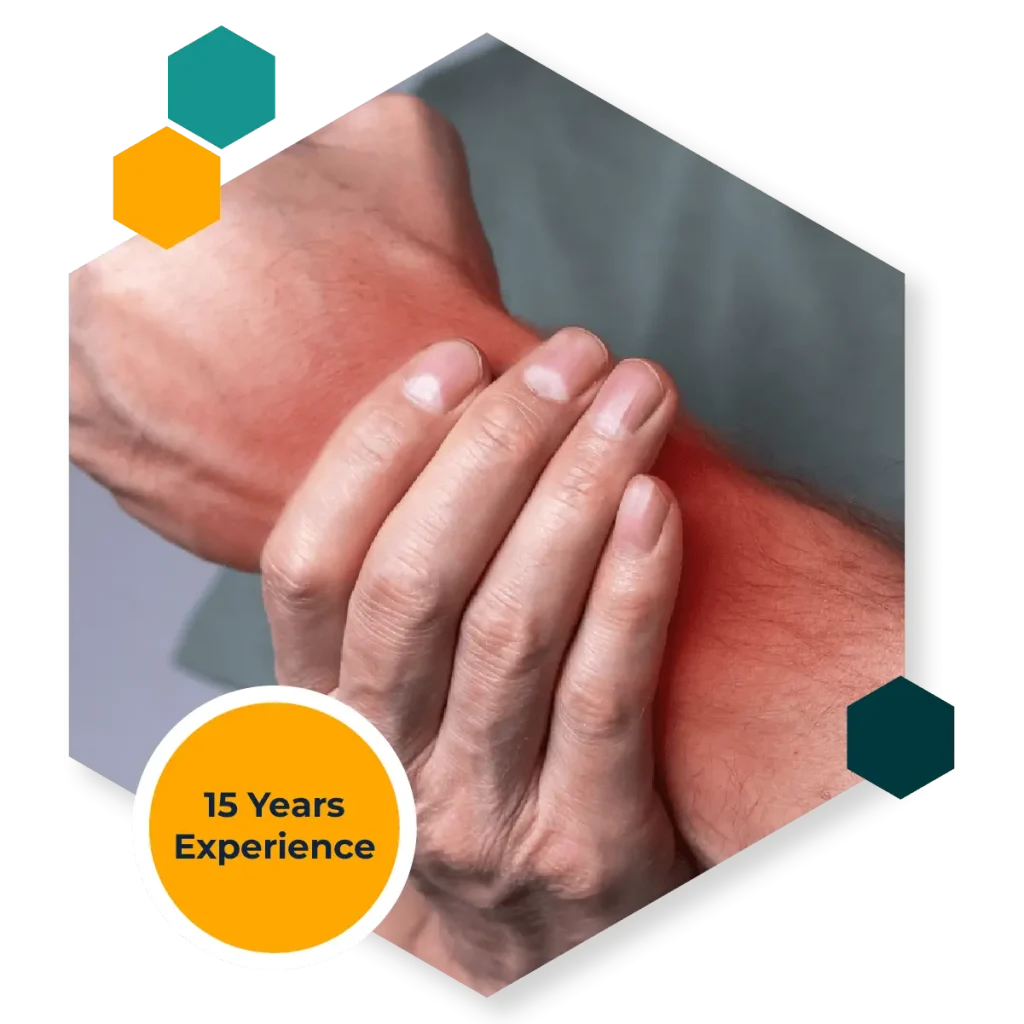 Carpal Tunnel Syndrome (CTS)