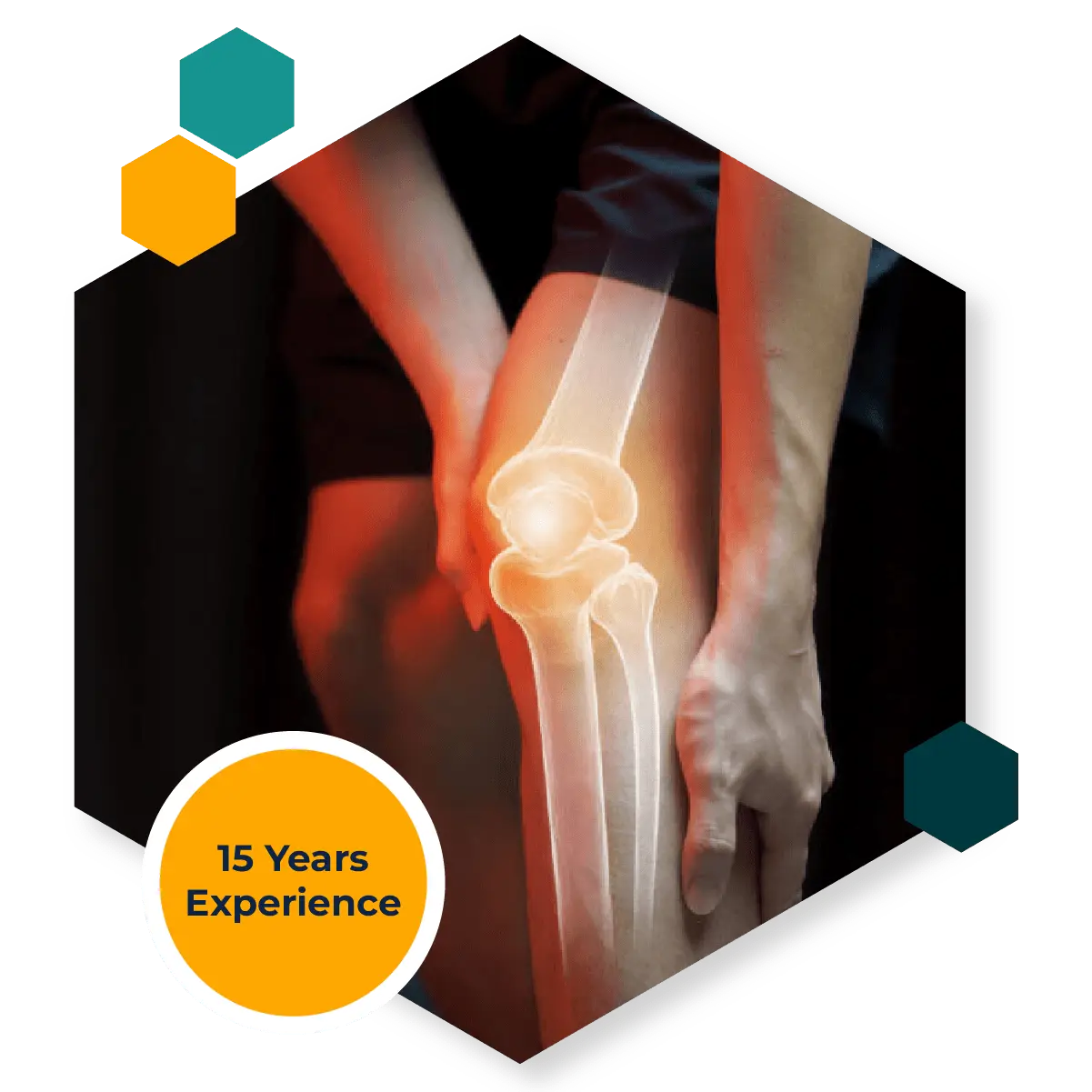 Collateral Ligament Repair