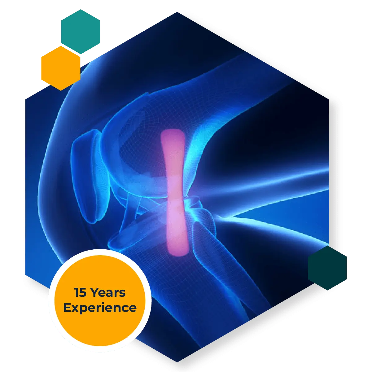Collateral Ligament Repair