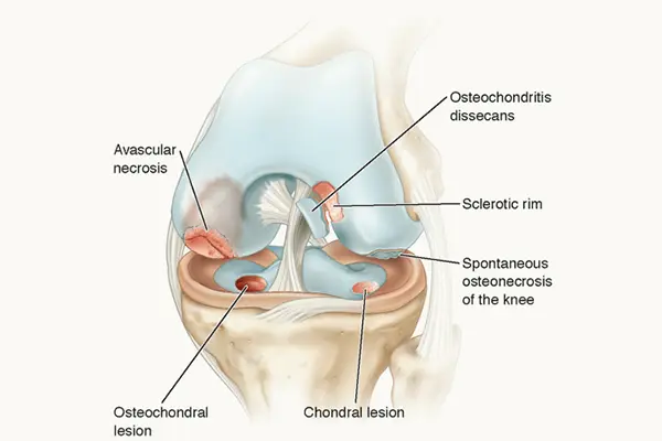 Key Highlights of OCD Treatment in Dubai: