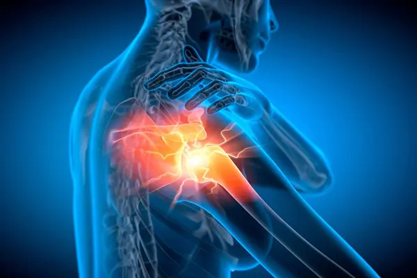 Key Highlights of PRP for Shoulder & Patellar Tendon