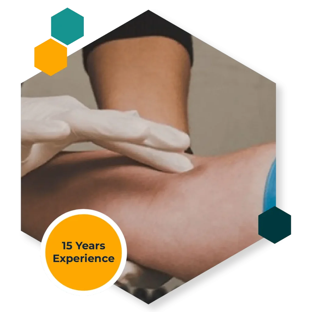 PRP for Tennis Elbow