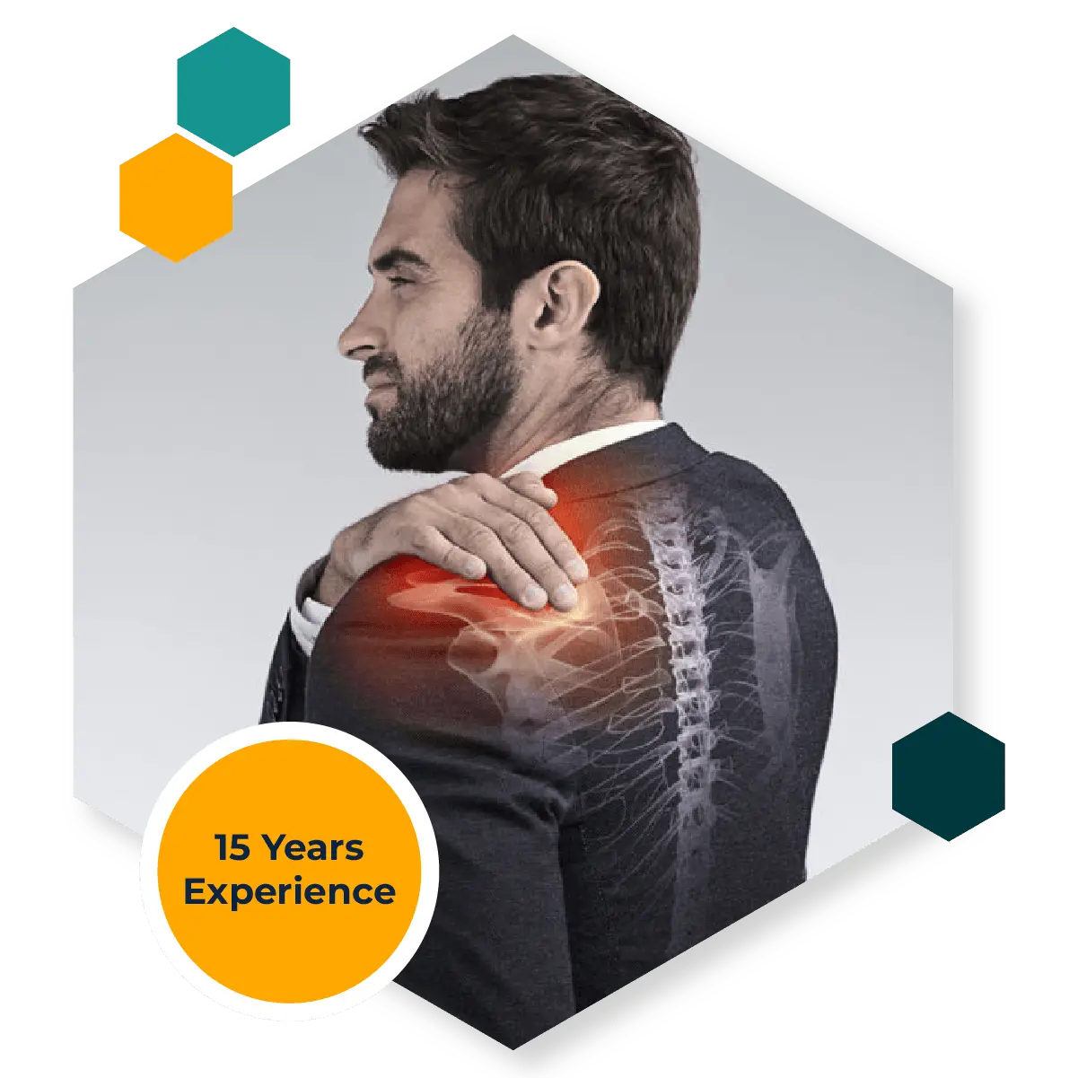 Shoulder instability