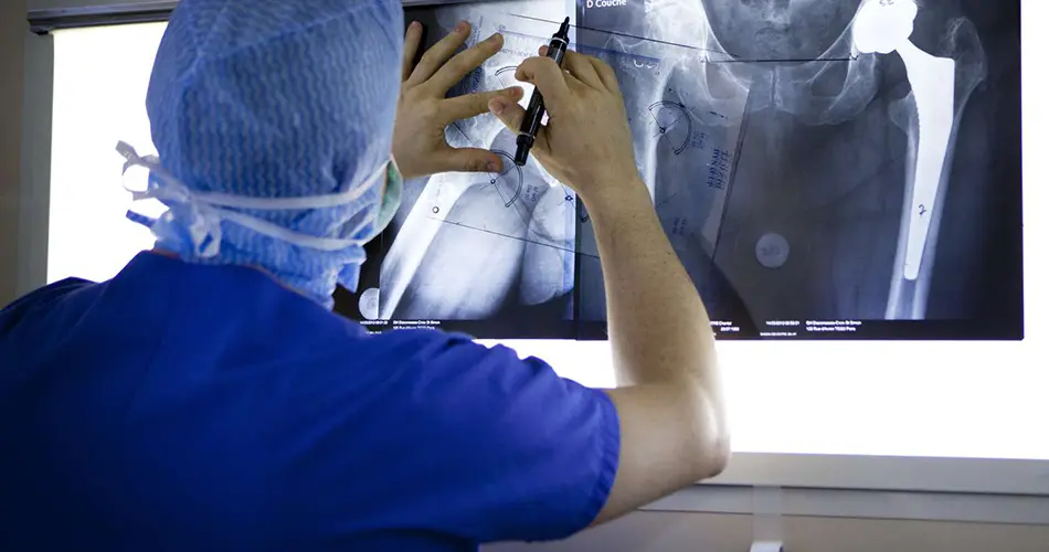 Why Consider Hip Arthroplasty in Dubai?