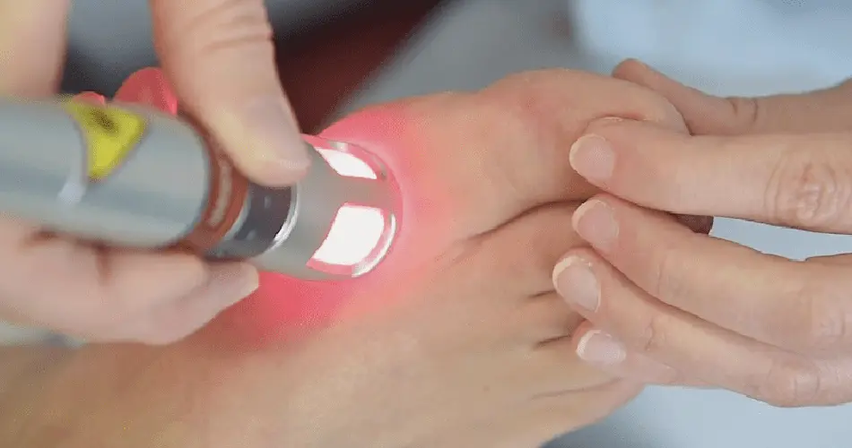 Why Consider Bunion Surgery in Dubai?