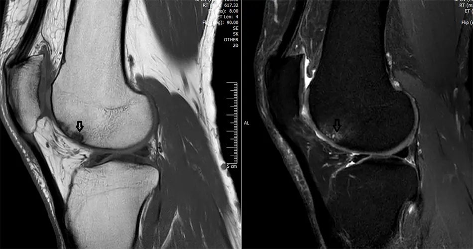 Why Consider OCD Treatment in Dubai?